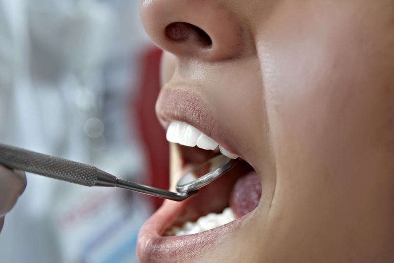 Болезни десен — одна из главных причин потери зубов у взрослых